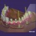 Cad Сam системы в стоматологии под ключ 