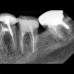 Vatech EzSensor-Радиовизиограф стоматологический 